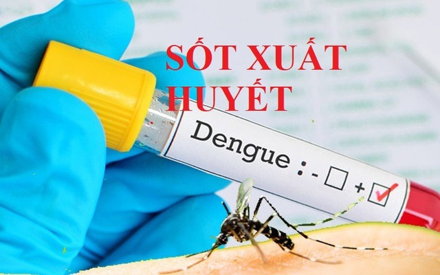 CDC Hà Nội cập nhật tình hình dịch sốt xuất huyết, sởi, viêm màng não (01/10/2024)